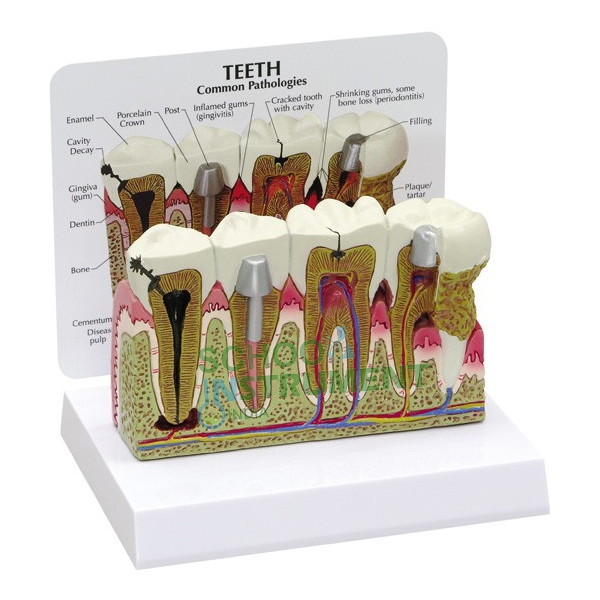 Teeth Model With Description Plate